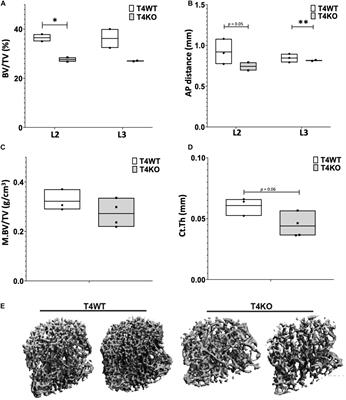 TLE4 Is a Critical Mediator of Osteoblast and Runx2-Dependent Bone Development